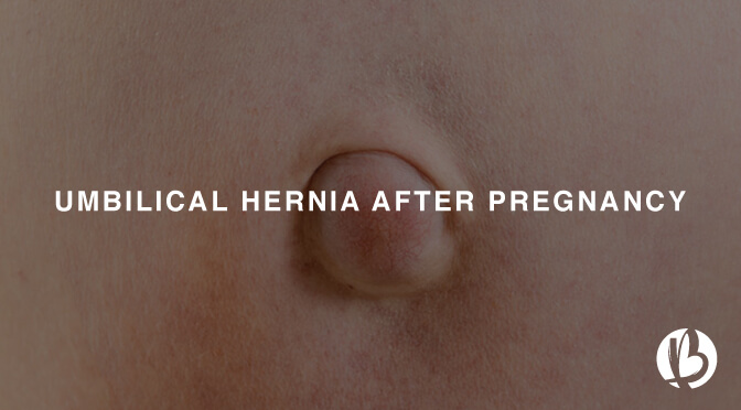 can an umbilical hernia cause a dog to stop walking